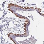 YLAT2 Antibody in Immunohistochemistry (Paraffin) (IHC (P))