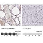 HIRA Polyclonal Antibody