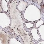 HIRA Antibody in Immunohistochemistry (IHC)