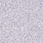 HIRA Antibody in Immunohistochemistry (IHC)