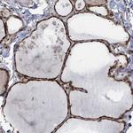 ZBTB14 Antibody in Immunohistochemistry (Paraffin) (IHC (P))