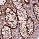 ZMYND19 Antibody in Immunohistochemistry (Paraffin) (IHC (P))