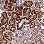ZMYND19 Antibody in Immunohistochemistry (Paraffin) (IHC (P))