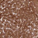 ZMYND19 Antibody in Immunohistochemistry (Paraffin) (IHC (P))