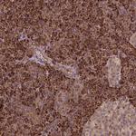 ZMYND19 Polyclonal Antibody