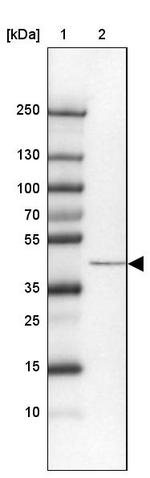 SCCPDH Antibody in Western Blot (WB)