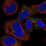 CHCHD7 Polyclonal Antibody