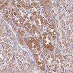 CHCHD7 Antibody in Immunohistochemistry (Paraffin) (IHC (P))