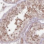 DR1 Polyclonal Antibody