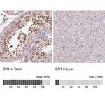 DR1 Antibody in Immunohistochemistry (IHC)