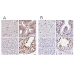 DR1 Antibody in Immunohistochemistry (IHC)