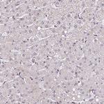 DR1 Antibody in Immunohistochemistry (IHC)