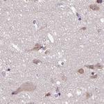 DR1 Antibody in Immunohistochemistry (IHC)
