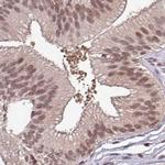 DR1 Antibody in Immunohistochemistry (IHC)