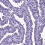 SPEF1 Polyclonal Antibody