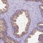 SPEF1 Antibody in Immunohistochemistry (Paraffin) (IHC (P))