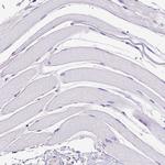 SPEF1 Antibody in Immunohistochemistry (Paraffin) (IHC (P))