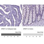 SPEF1 Antibody in Immunohistochemistry (IHC)