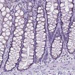 SPEF1 Antibody in Immunohistochemistry (IHC)