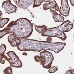 ATP10D Antibody in Immunohistochemistry (Paraffin) (IHC (P))