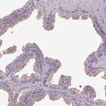 ISLR Antibody in Immunohistochemistry (IHC)