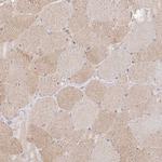 ISLR Polyclonal Antibody