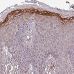 ISLR Antibody in Immunohistochemistry (IHC)