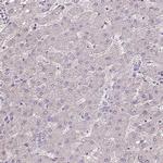 ISLR Antibody in Immunohistochemistry (IHC)