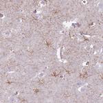 FAM43B Antibody in Immunohistochemistry (Paraffin) (IHC (P))
