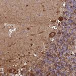 PCED1A Antibody in Immunohistochemistry (Paraffin) (IHC (P))