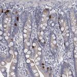 SLC25A45 Antibody in Immunohistochemistry (Paraffin) (IHC (P))
