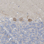 SLC25A45 Antibody in Immunohistochemistry (Paraffin) (IHC (P))