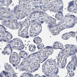SLC25A45 Antibody in Immunohistochemistry (Paraffin) (IHC (P))
