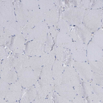 SLC25A45 Antibody in Immunohistochemistry (Paraffin) (IHC (P))