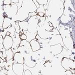 TUSC5 Polyclonal Antibody