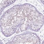 BDKRB2 Polyclonal Antibody