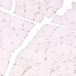 TET3 Antibody in Immunohistochemistry (IHC)