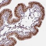 C14orf4 Antibody in Immunohistochemistry (Paraffin) (IHC (P))