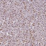 C14orf4 Antibody in Immunohistochemistry (Paraffin) (IHC (P))
