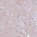 C14orf4 Antibody in Immunohistochemistry (Paraffin) (IHC (P))