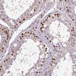 C14orf4 Antibody in Immunohistochemistry (Paraffin) (IHC (P))