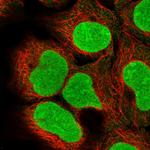 DCUN1D5 Polyclonal Antibody