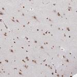 DCUN1D5 Antibody in Immunohistochemistry (Paraffin) (IHC (P))