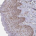 DCUN1D5 Antibody in Immunohistochemistry (Paraffin) (IHC (P))