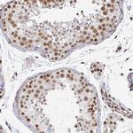 DCUN1D5 Antibody in Immunohistochemistry (Paraffin) (IHC (P))