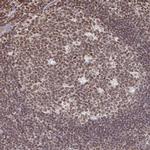DCUN1D5 Antibody in Immunohistochemistry (Paraffin) (IHC (P))