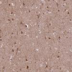 ZNF391 Antibody in Immunohistochemistry (Paraffin) (IHC (P))