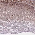 ZNF391 Polyclonal Antibody