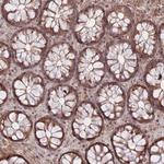 ZNF391 Antibody in Immunohistochemistry (Paraffin) (IHC (P))