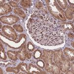ZNF391 Antibody in Immunohistochemistry (Paraffin) (IHC (P))
